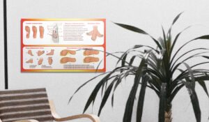 Стенд «Плоскостопість»